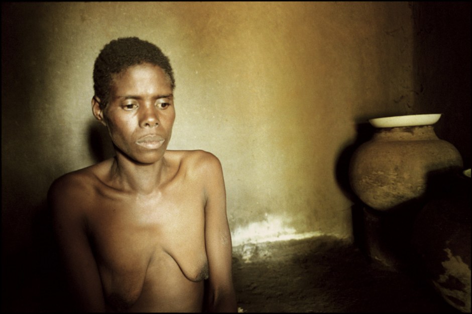 Malawi, 2001
Catherine, 35 years old. She has had three husbands. All of them  died of Aids.  She's suffering from Aids. She thinks that she's suffering from tuberculosis. She's getting more and more weak. She can't work anymore. She hasn't eaten in four months. She will leave four children. 

Malawi, 2001
Catherine, 35 ans. Elle a eu 3 maris. Ils sont tous morts du sida. Elle est atteinte du sida. Elle pense souffrir de la tuberculose. Elle est de plus en plus faible, elle ne peut pus travailler. Elle n'a rien mangé depuis 4 mois. Elle laissera 4 enfants orphelins.
 
Samuel Bollendorff / Agence VU