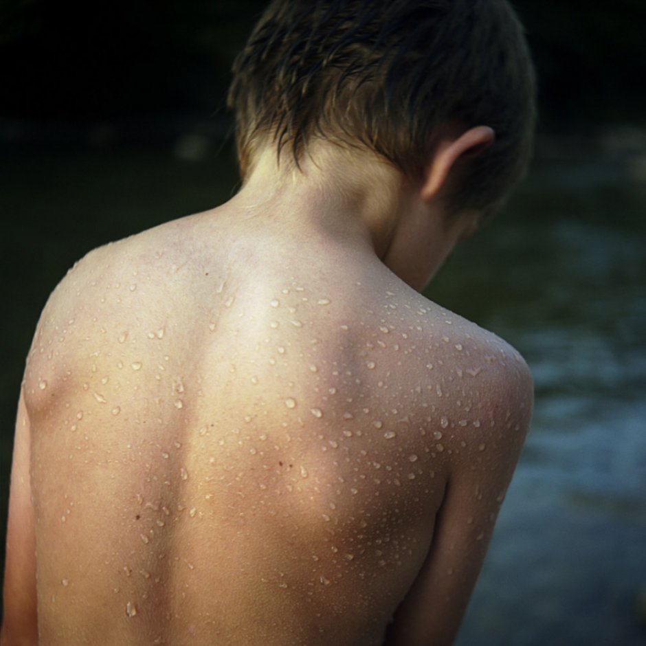 France, Musculdy, 2008 - From the series "A contretemps".