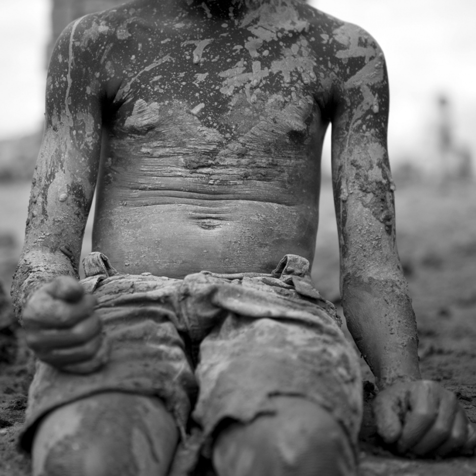 Burundi, Bujumbura, Buhumba bricks production site, November 2011Jean Claude Nkurunziza 9 years old, is making bricks at the production site.Jean Claude's mother killed his father after years of beating. She is now in Mpimba prison. Leaving her eight children to look after themselves. The Sisters work in the field in order to feed the youngest while the oldest brother doesn't help. Jean Claude lives with his aunt and cousins and has to work 13 hours, making 900 to 1000 bricks a day to earn 1500 burundian francs (about 1.2 US dollar). Just enough to buy him a fritter... Later, he wants to go to school to become a pilot. Burundi, Bujumbura, fabrique de briques de Buhomba, novembre 2011Le torse de Jean Claude Nkurunziza, 9 ans, ‡ la fabrique de brique.La mËre de Jean Claude a tuÈ son pËre aprËs avoir ÈtÈ battue pendant des annÈes, et est maintenant dÈtenue ‡ la prison de Mpimba. En son absence, ces huit enfants s'en sortent comme ils peuvent. Tandis que les soeurs travaillent dans les champs et parviennent parfois ‡ acheter ‡ manger aux plus petits, l'ainÈ, mariÈ, ne leur vient pas en aide. Jean Claude vit avec sa tante et ses cousins, mais puisque il n'y a pas de quoi nourrir tout le monde, il fabrique 900 ‡ 1000 briques par jour (en travaillant pendant 13 heures) pour gagner la somme de 1500 francs burundais (1.2 dollar US). Juste de quoi s'acheter un beignet... Plus tard, il voudrait aller ‡ l'Ècole pour devenir pilote d'avions.Martina Bacigalupo / Agence VU