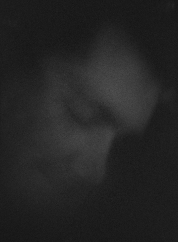 Sweden, 18 July 2019From the series "August Song".Suède, 18 juillet 2019Issue de la série "August Song".Martin Bogren / Agence VU