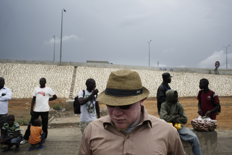 Senegal, Thiès, 28 March 2012Mohamadou Bamba Diop, president of the National Association of Albinos from Senegal (ANAS), in a street in the inner suburbs of Dakar.Sénégal, Thiès, 28 mars 2012Mohamadou Bamba Diop, président de l'Association Nationale des Albinos du Sénégal (ANAS), dans une rue à la périphérie de Dakar.Michael Zumstein / Agence VU