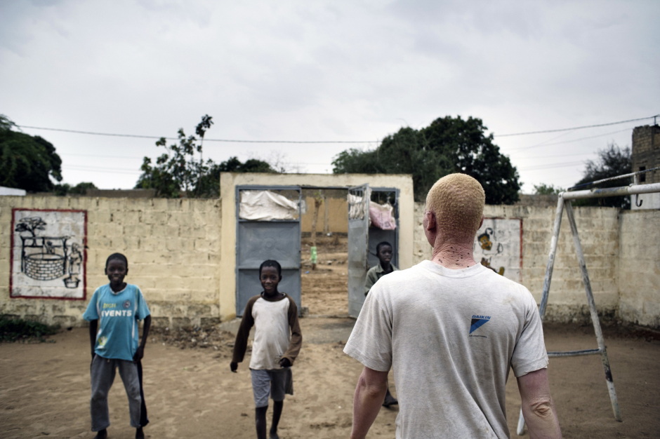 Senegal, Thiès, 28 March 2012A young man is living the foster home created by Mohamadou Bamba Diop, president of the National Association of Albinos from Senegal (ANAS).Sénégal, Thiès, 28 mars 2012Un jeune albinos quitte le centre d'accueil créé par Mohamadou Bamba Diop, président de l'Association Nationale des Albinos du Sénégal (ANAS).Michael Zumstein / Agence VU