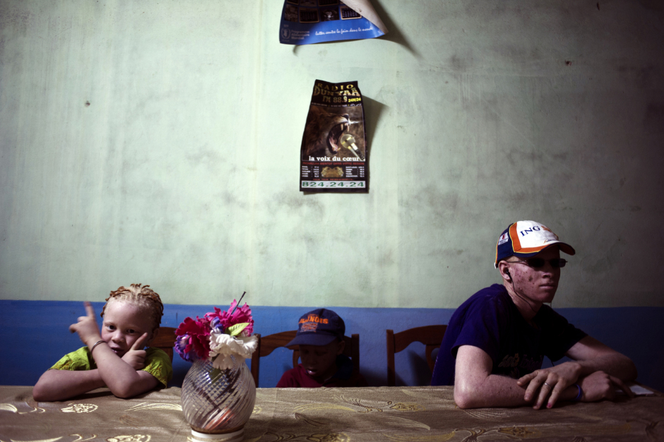 Senegal, Thiès, 28 March 2012Fabimeta Diop and a young men in a room of foster home created by Mohamadou Bamba Diop, president of the National Association of Albinos from Senegal (ANAS).Sénégal, Thiès, 28 mars 2012Fabimeta Diop et un jeune homme dans une salle du centre d'accueil créé par Mohamadou Bamba Diop, président de l'Association Nationale des Albinos du Sénégal (ANAS).Michael Zumstein / Agence VU