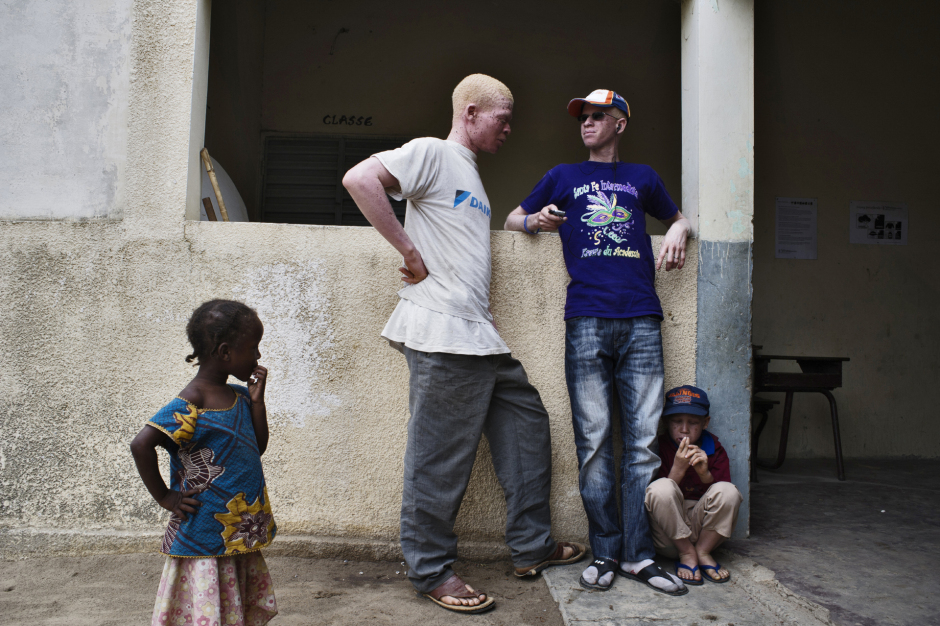Senegal, Thiès, 28 March 2012Inside the foster home created by Mohamadou Bamba Diop, president of the National Association of Albinos from Senegal (ANAS).Sénégal, Thiès, 28 mars 2012Dans le centre d'accueil créé par Mohamadou Bamba Diop, président de l'Association Nationale des Albinos du Sénégal (ANAS).Michael Zumstein / Agence VU